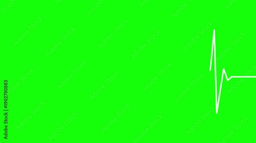 Medical heart rhythm diagram ascending animation, EKG heartbeat line 4k video on green screen. Cardiogram monitor to use for healthcare, healthy lifestyle, medical laboratory, cardiology project.