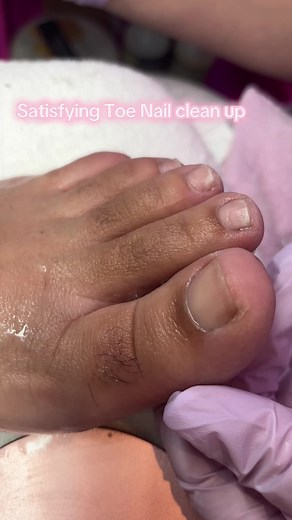 Satisfying Toe Nail Clean Up Tutorial