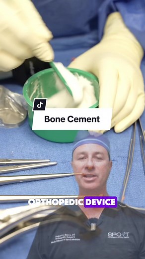 Ever wonder how new joints stay securely in place? Bone cement plays a key role! This special medical-grade cement, typically made of polymethylmethacrylate (PMMA), acts like glue to bond the artificial joint components to your existing bone. Here’s why it’s beneficial: Strong hold: Bone cement creates a powerful connection, ideal for patients with weaker bone density from conditions like osteoporosis. Immediate stability: Unlike uncemented implants that rely on bone growth for fixation, bone ce
