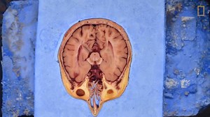 97K views · 1.1K reactions | Upon Susan Potter's death, her donated body was frozen, sliced 27,000 times, and photographed—transforming it into a striking virtual cadaver. Read the full story about her contribution to science: https://on.natgeo.com/2CzT7id | National Geographic History | Facebook