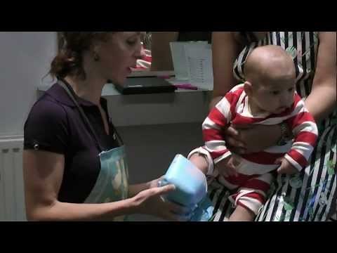 Baby Feet Casting - plaster cast alginate mould