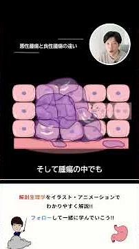 The difference between malignant and benign tumors #anatomyandphysiology