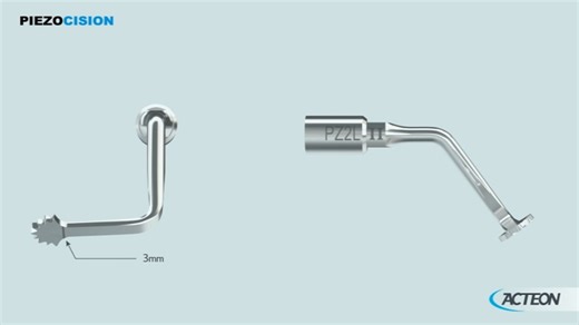 正畸加速PAOO Piezocision (TM) protocol