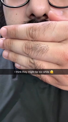 “I smiled during a Zoom call… and instantly regretted it.” The camera showed everything. My teeth looked way more yellow than I thought. I couldn’t stop staring at my own video box. Embarrassing. I ordered the DrDent whitening strips that kept popping up on my feed. Fast delivery. Zero sensitivity. 10 minutes a night. After 4 days? I felt confident leaving the camera ON. Now I smile in meetings. On purpose. Caution: May cause compliments from coworkers. | Drdent.co