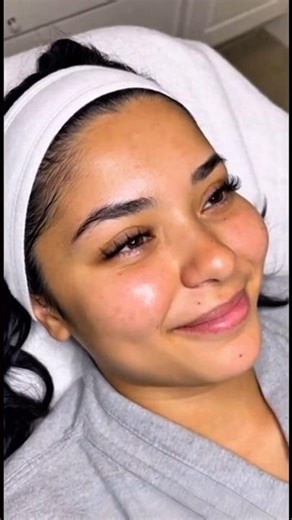 Deep Pore Vacuum Extraction Animation – So Relaxing to Watch relieved bubbles #asmrcommunity