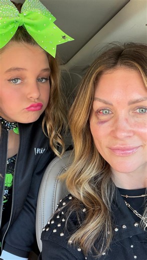 Ashlee Nichols on Instagram: "Just a little update for those that missed it…Thursday morning Boots, our Maine Coon, clawed my cornea 🫣 it’s been quite the healing process but I am SO thankful for God’s hand in the timing, the Drs and the help I had this week! Truly the weirdest most painful experience of my life, and I don’t wish this on a single soul. I don’t know what got into him, but we’re doing all that we can to find out and prevent. Like my mother in law said, even the best of animals st