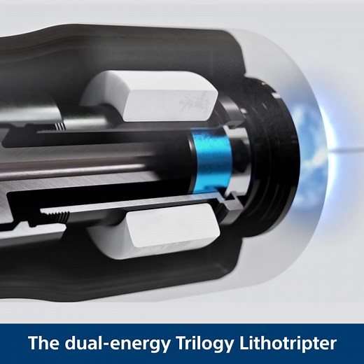 Performance and efficiency matter. Download the brochure to see the data behind the new Trilogy Max Lithotripter: | Boston Scientific