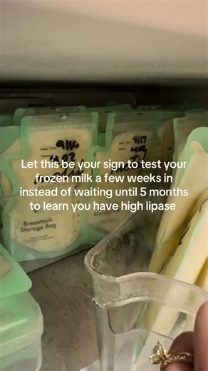 Understanding High Lipase in Breast Milk