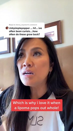 Reply to @sherry_boymom sometimes lipomas are hard to remove because they get wound up around normal fibrous tissue under the skin...#drpimplepopper