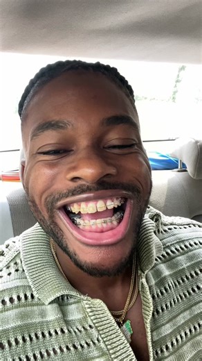 Surprising Reactions That Will Make You Laugh