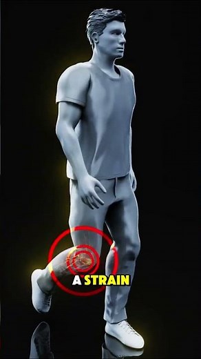 ACL Surgery, Knee Reconstruction – Symptoms #3danimation #kneereplacementoperation #kneesurgey