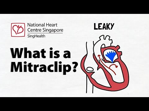 Transcatheter Mitral Valve Repair | Benefits and Risks of a Mitraclip
