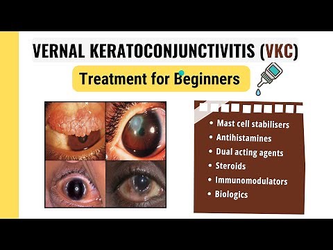 How to Treat Vernal Keratoconjunctivitis: What You Need to Know
