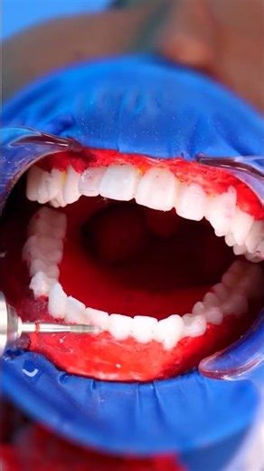 Sparkling smile energy — feeling brand new! 🌟👄