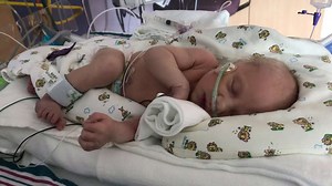 Baby in the NICU Has Squeaky Hiccups