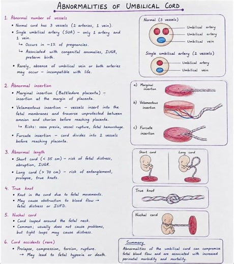 Abnormalities of Umbilical Cord Handwritten Notes | OBG Nursing Notes | Gsmedico