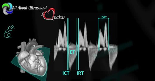 Understanding the Tei Index (MPI): A Measure of Heart Efficiency | All About Ultrasound posted on the topic | LinkedIn