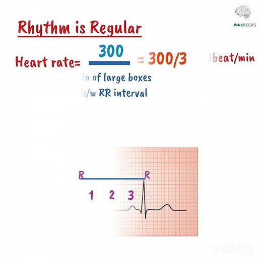 How to calculate Heart Rate From ECG | Clinical Cardiology