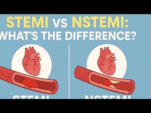 “STEMI vs NSTEMI Heart Attack | Types, Symptoms & Treatment Explained”