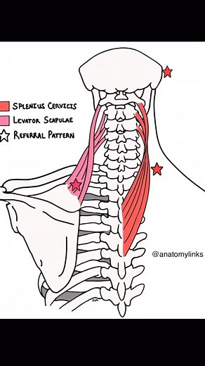 6.8K views · 159 reactions | NECK-UPPER BACK PAIN LINKS- Comparing...