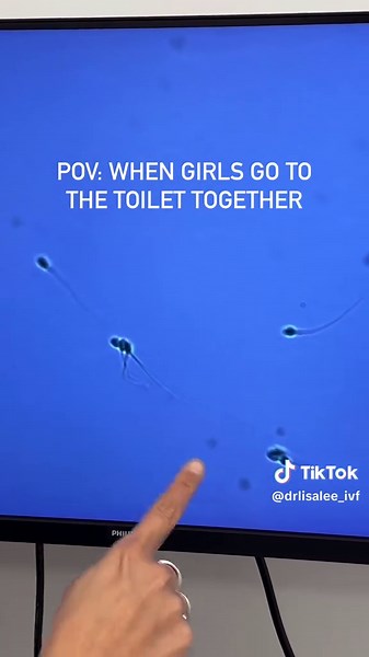 Just a few spermies deciding to swim around together 😂🏊🏻‍♀️ #sciencehumor #andrology #semenanalysis #ivf #icsi #embryology #embryologylife #swimmers