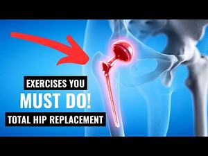 You MUST Do This After Hip Replacement!