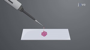 Effect of storage temperature on nucleic acid quality in formalin-fixed paraffin-embedded tissue samples - Watch Related Videos