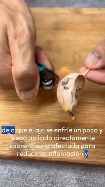 ¡Prueba Esto! Quema Ajo y Alivia Dolor de Muelas Rápidamente 💥 #saludnatural #ajo