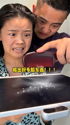Hair growth comb, amazing cool Beauty products #beauty