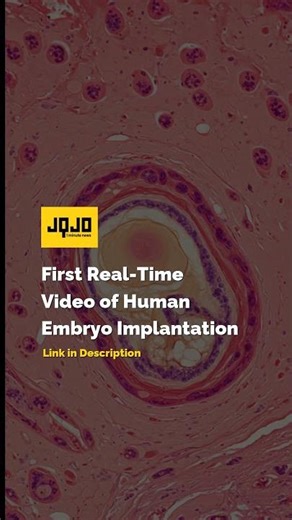 First Real-Time Video of Human Embryo Implantation