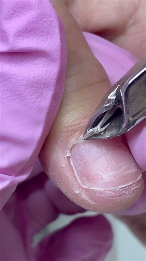 Dry Cuticle Removal with Nippers ASMR | Clean Cuticle