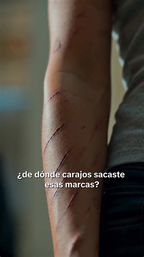 La verdad detrás de las cicatrices: causas y recuperación
