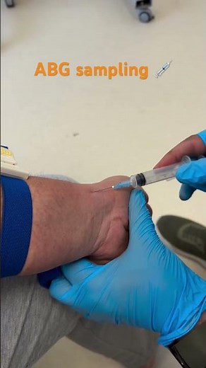 ABG sampling #nursingofficer #viralshort #viral #theprettynurse #medicalstudent