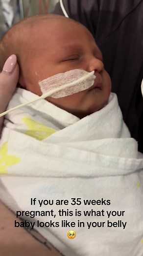 35 Weeks Pregnant: Your Baby's Development Journey