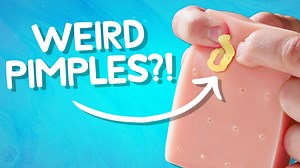 We filled the Pop It Pal with mystery materials to simulate the strangest pimples you've ever seen (and maybe didn't want to see). | Vat19.com