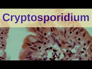 Cryptosporidium Infection - Pathology mini tutorials