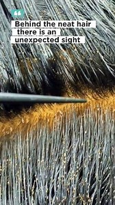 237K views · 441 reactions | No one expected there to be this many lice in her hair #HeadLice #LiceRemoval #HairLice #LiceTreatment #ScalpCare #HairCleaning | Ahmad | Facebook