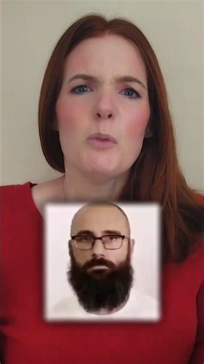 Why Bald Men Often Grow the Best Beards