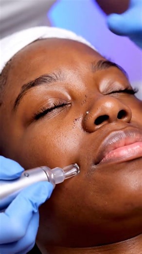 This Full-Face Vacuum Pore Cleaning Is So Satisfying Ultra-Realistic ASMR#viral #shorts #shortvideo