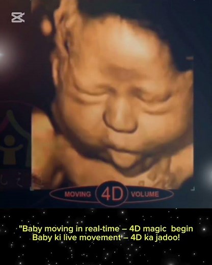 FETUS REVEALED in Stunning 2D 3D 4D Ultrasound Scan?#fetal#pregnancy