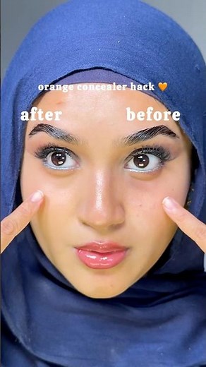 AD Watch my dark circles disappear instantly 💖✨#EraserConcealer #ColourCorrector ​⁠‪@maybellineuk‬