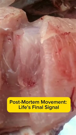 34K views · 208 reactions | What you’re seeing is called post-mortem movement. It happens when calcium, sodium, and potassium are still active in the muscle after death — triggering one final contraction. It’s not a glitch. It’s real biology. The same minerals that power movement in animals power it in humans too. Different species, same design. #PostMortemMovement #ElectricBiology | Wellnessradar | Facebook