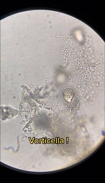 Microscopic Discoveries That Changed How We See the World