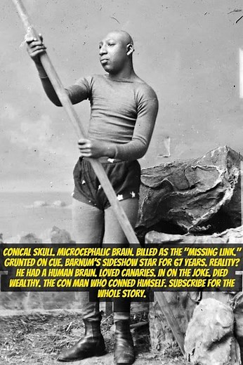 Zip the Pinhead – The Sideshow Hoax Who Outsmarted Everyone
