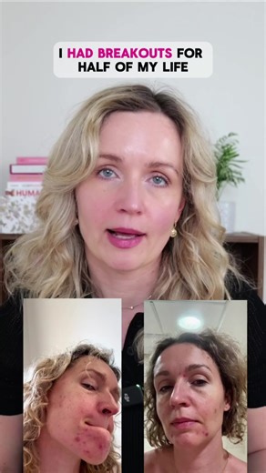 So THIS is why I had breakouts… 😳 Gentle skincare can still cause breakouts, especially for acne-prone and sensitive skin. 💖 Use SkinBuddy to check which products are really safe for your skin. Stop guessing and protect your skin today! #SensitiveSkin #AcneProneSkin #BreakoutProneSkin #Breakouts #SafeSkincare #SkincareTips #IngredientCheck #SkinBuddy #GentleSkincare #ClearSkin #HealthySkin