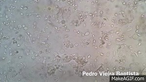 Trichomonas vaginalis (wet mount preparation, 200x) on Make a GIF