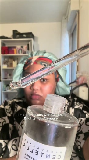 -5% code parrainage yesstyle: NAMJALYSSIA1 #acneproneskin #shorts #skintransformation #skin1004