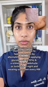 330K views · 143 reactions | Combining glycolic acid and retinoids...