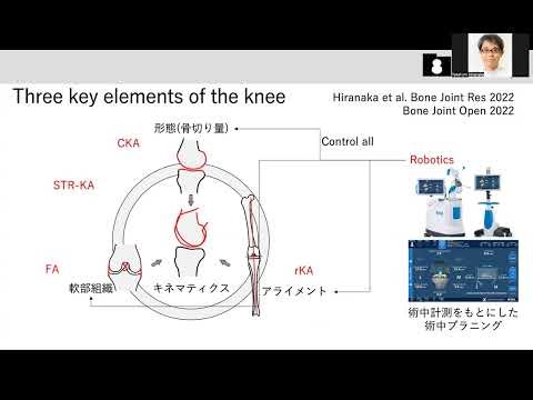Knee Arthroplasty Lecture KA TKA princilpe ６