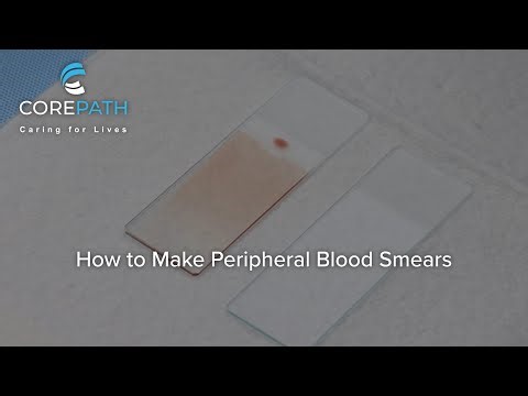 How to Make Peripheral Blood Smears